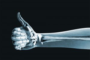 good bone health